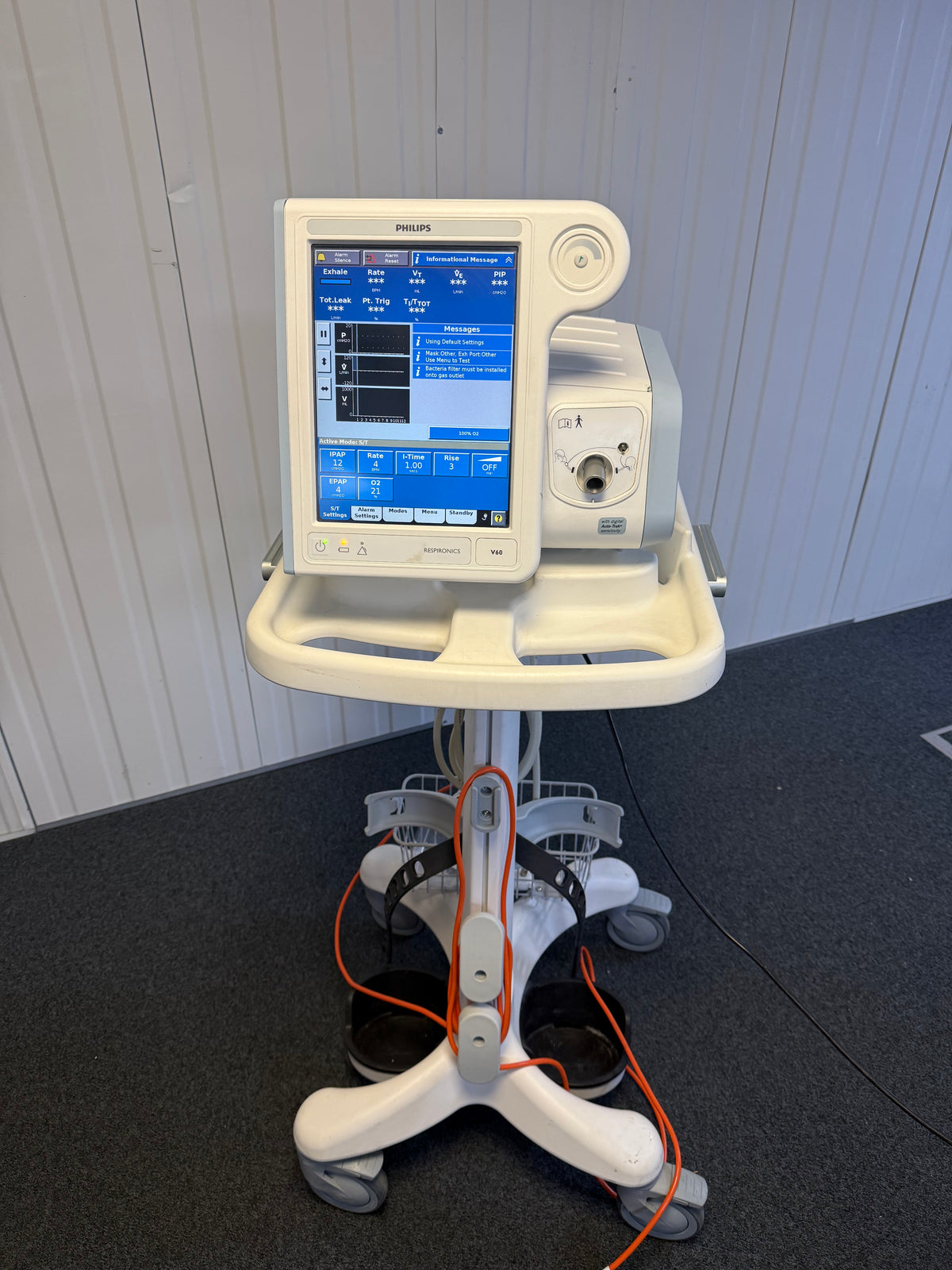 Auto-Trak enabled Philips V60 ventilator in hospital respiratory unit