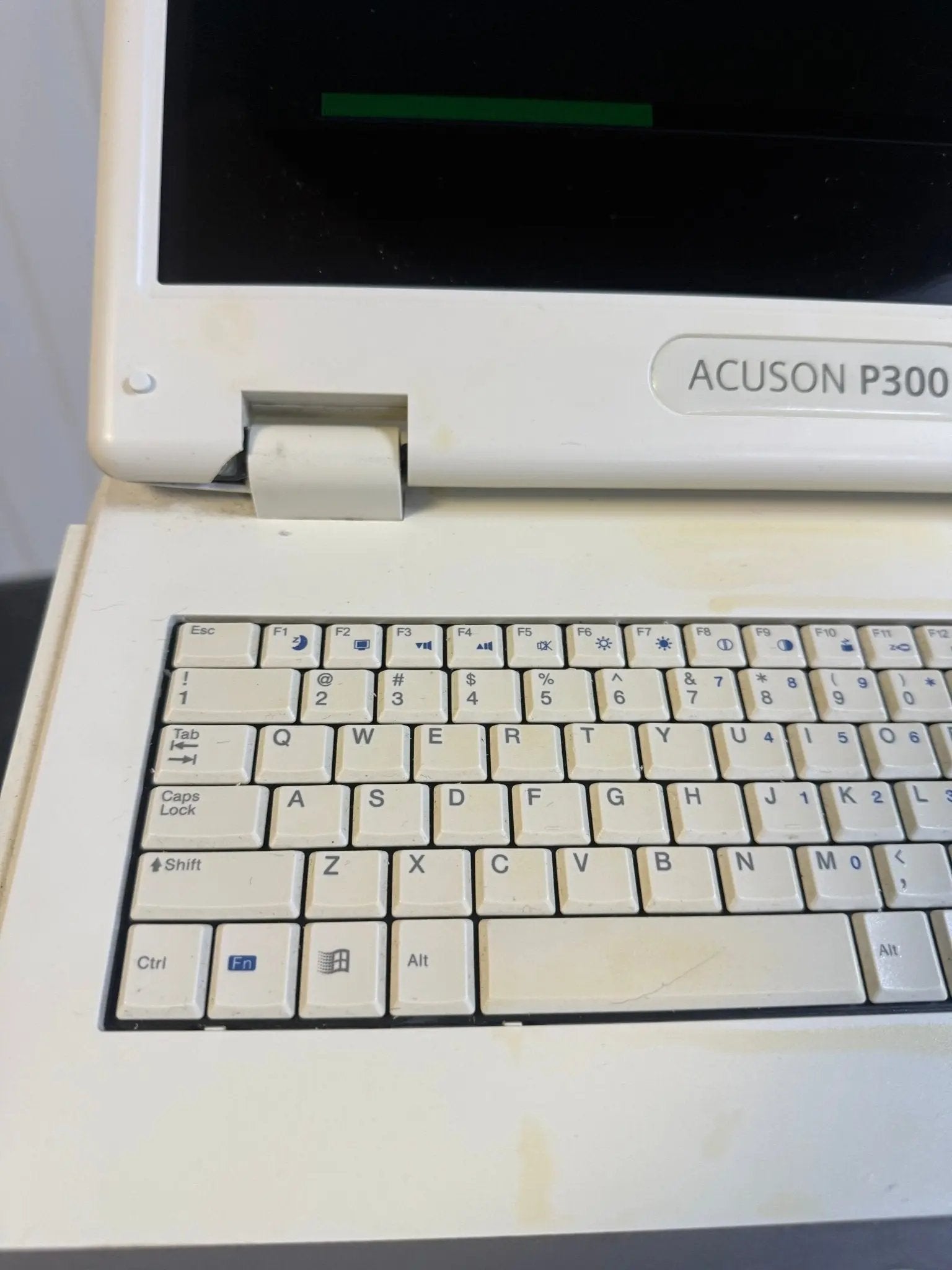 Siemens Acuson P300 Portable Ultrasound System **NO HDD** - SelfiMed UK