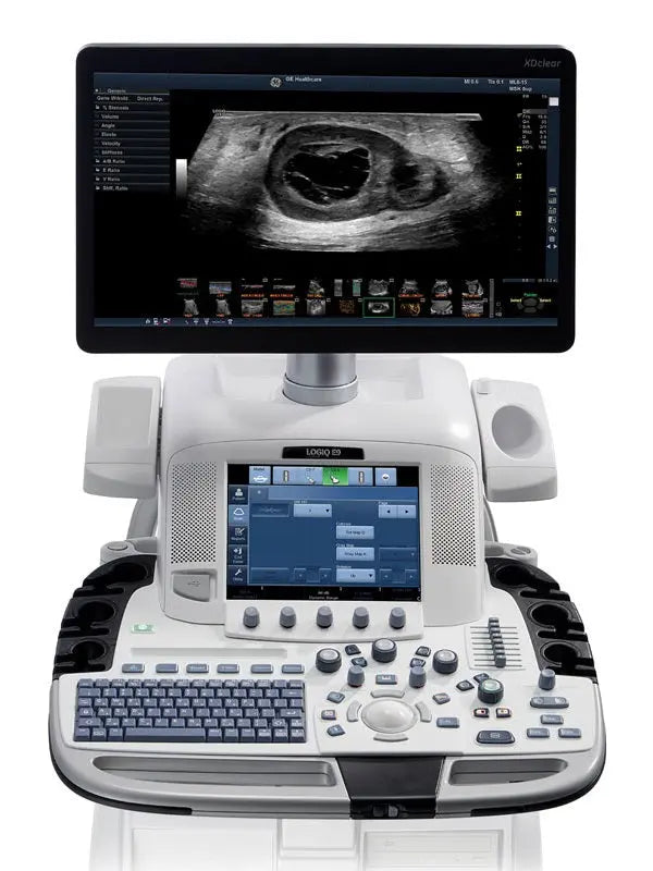 GE Ultrasound Machine: A Complete Guide to Features and Benefits
