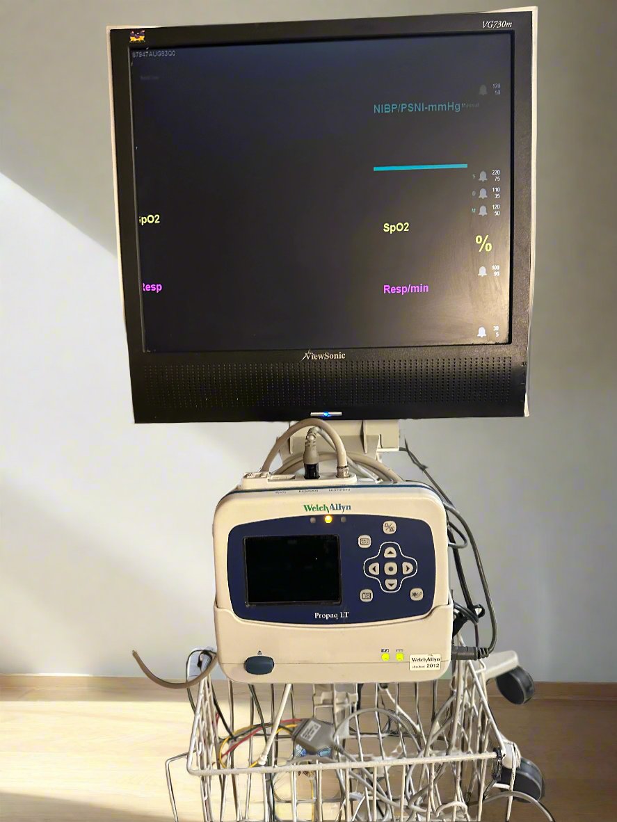 Welch Allyn Propaq LT Vital Signs Monitor with Propaq LT Large Color Display Interface & ViewSonic VG730M Monitor on Stand