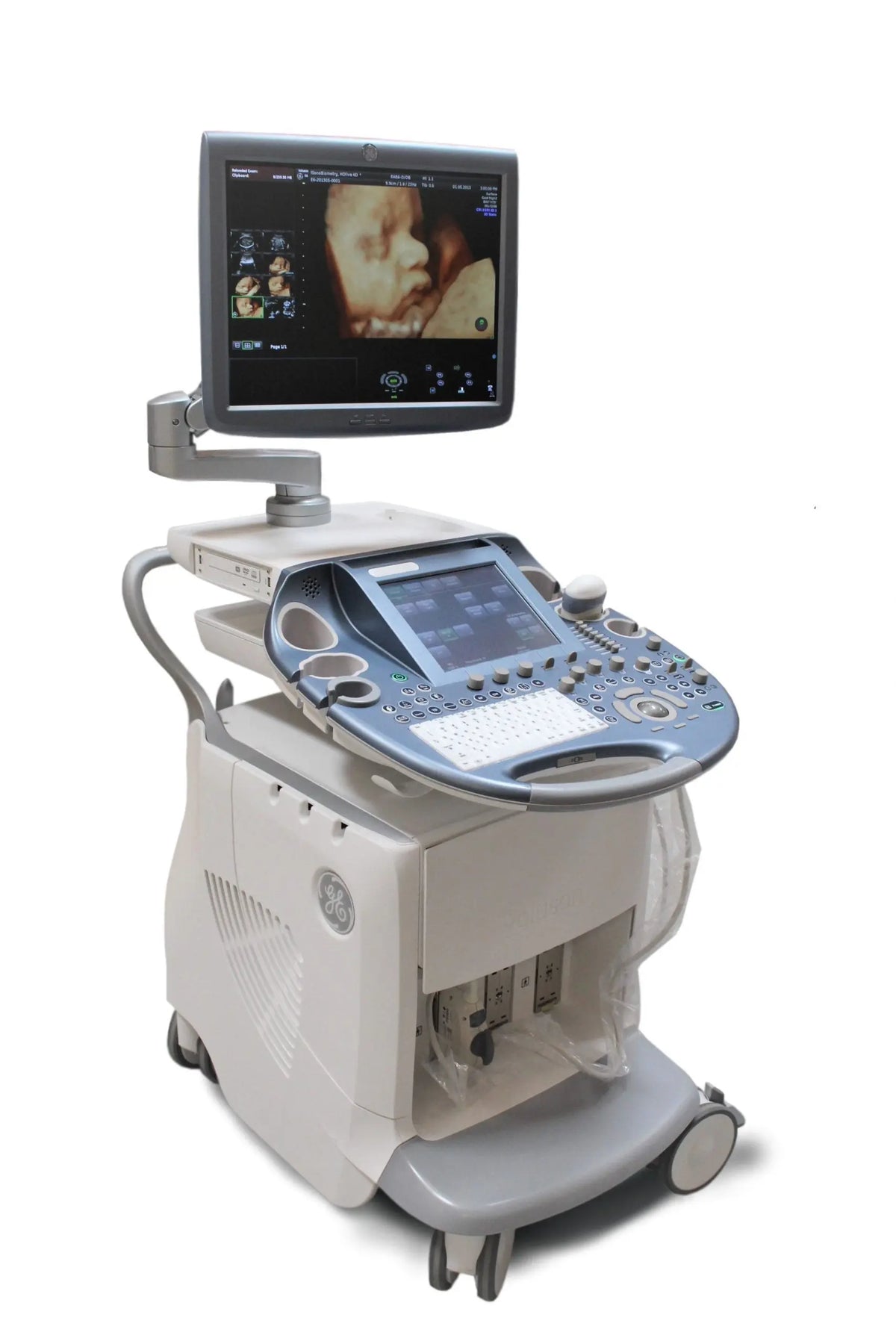 GE Voluson E6 Ultrasound Machine (2011) with Mitsubishi P90 Printer / Sony DVD Recorder DVO - 1000MD
Manufactured: 2011 Serial No: D53667 Software: Voluson E6 B 10.0.2.395 SelfiMed UK