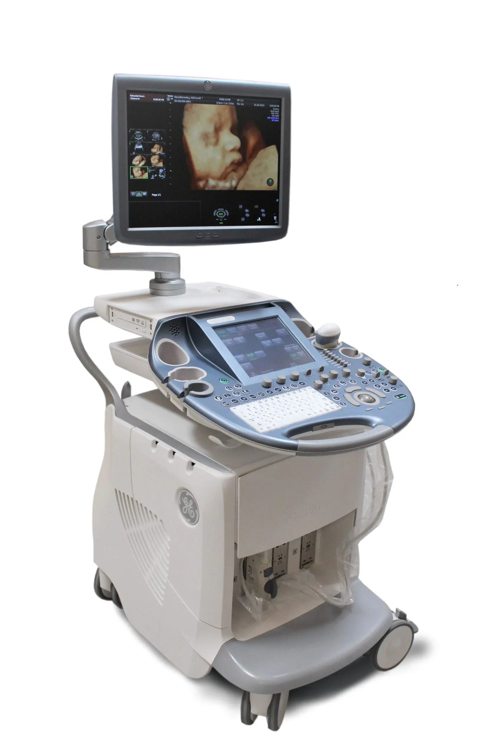 GE Voluson E6 Ultrasound Machine (2011) with Mitsubishi P90 Printer / Sony DVD Recorder DVO - 1000MD
Manufactured: 2011 Serial No: D53667 Software: Voluson E6 B 10.0.2.395 SelfiMed UK