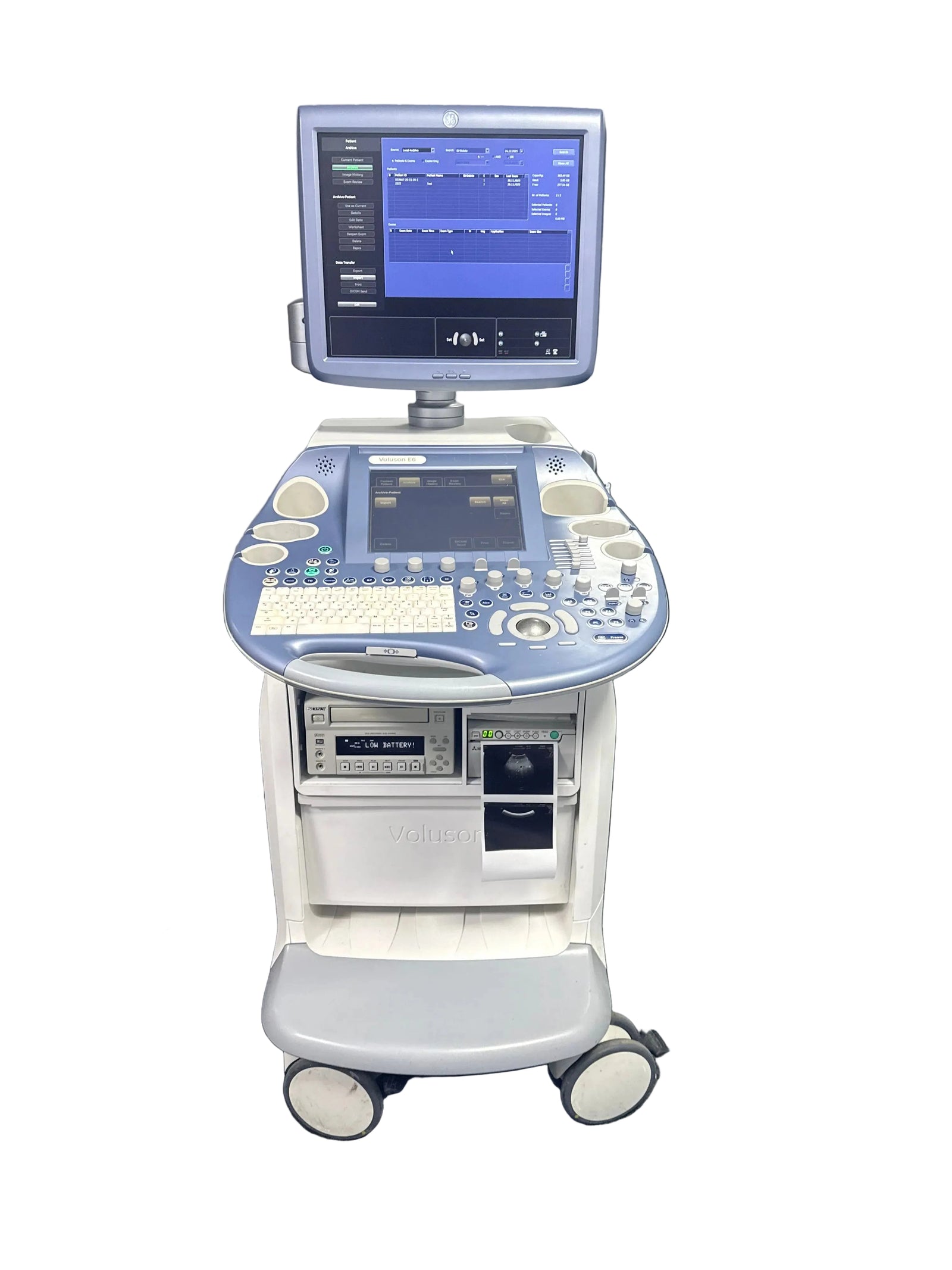 GE Voluson E6 Ultrasound Machine (2011) with Printer and DVD Recorder Ultrasound Machine SelfiMed UK