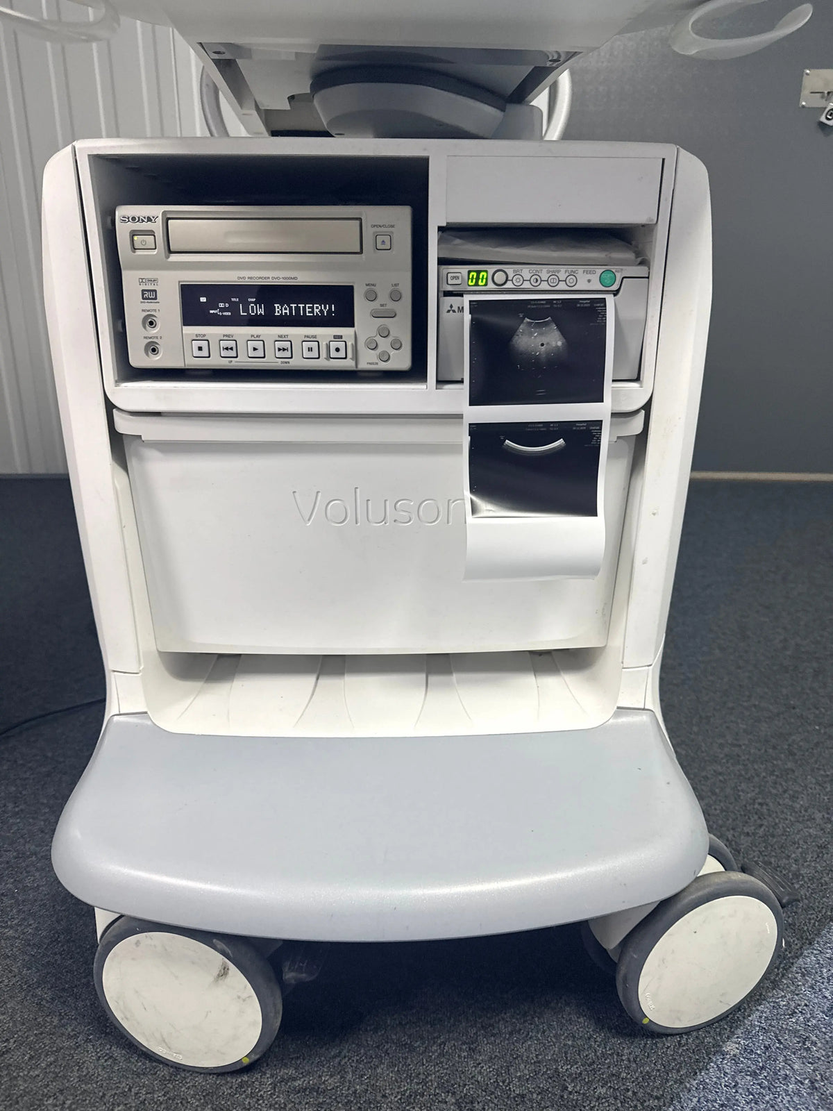 GE Voluson E6 Ultrasound Machine (2011) with Printer and DVD Recorder SelfiMed UK