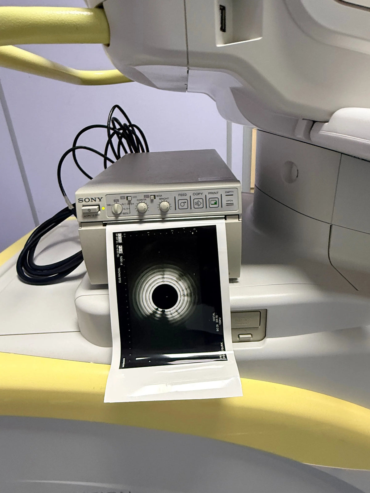 Hitachi Hi-Vision Avius Ultrasound Machine System SelfiMed UK