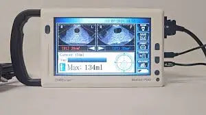 CubeScan BioCon 700 Bladder Scanner on a trolley stand- Missing Power Supply SelfiMed UK