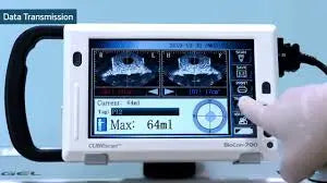 CubeScan BioCon 700 Bladder Scanner on a trolley stand- Missing Power Supply SelfiMed UK